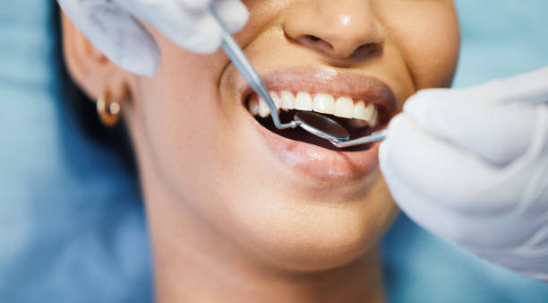 Best Emergency Tooth Extraction in Krebs, OK