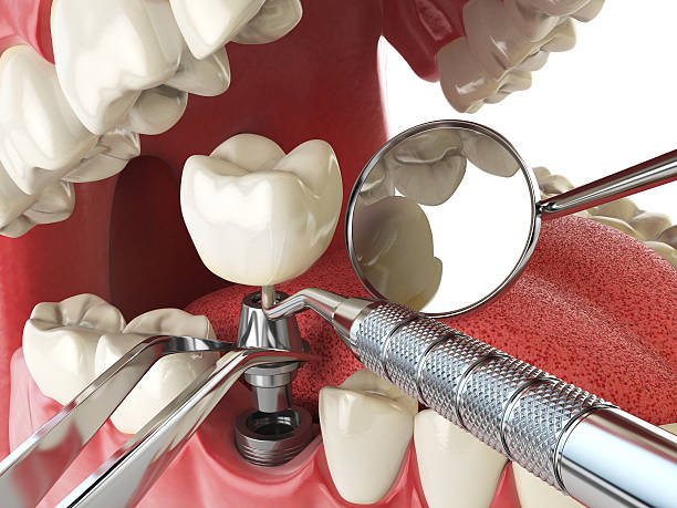 Best Emergency Dental Care for Broken or Chipped Teeth in Krebs, OK
